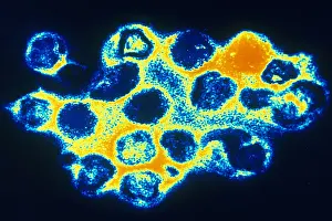Virus Prints: TEM of Rubella (German Measles)
