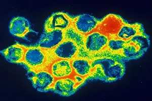 Virus Prints: TEM of Rubella (German Measles)