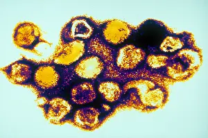 Virus Prints: TEM of Rubella (German Measles)