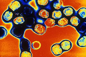 TEM of Vaccinia Virus
