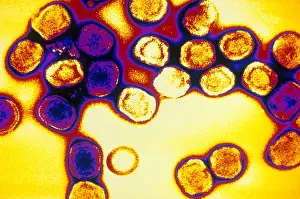 Virus Prints: TEM of Vaccinia Virus
