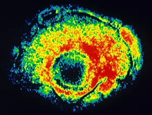 Tems Prints: TEM of Varicella
