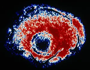 Tems Prints: TEM of Varicella