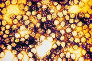 Virus Prints: TEM of Yellow Fever