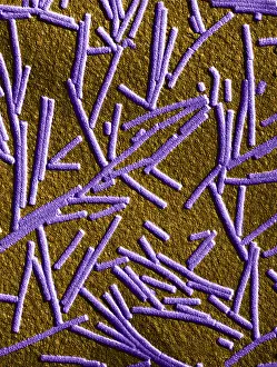 Mosaic Prints: Tobacco mosaic Virus, TEM