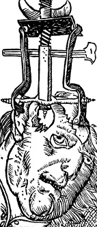 Intervention Prints: Trepanning, 1525