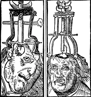 Intervention Prints: Trepanning, 1525