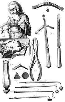 Operating Prints: Trepanning, 1772