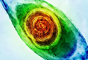 Fibers Prints: Trichinella in Muscle, light micrograph