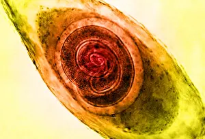 Fibers Prints: Trichinella in Muscle, light micrograph