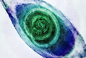 Fibers Prints: Trichinella in Muscle, light micrograph