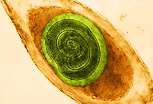 Fibers Prints: Trichinella in Muscle (LM) under a microscope