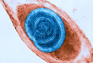Fibers Prints: Trichinella in Muscle (LM) under a microscope