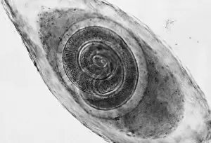 Fibers Prints: Trichinella in Muscle (LM) under a microscope