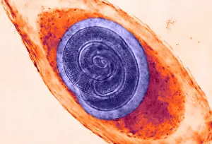 Fibers Prints: Trichinella in Muscle (LM) under a microscope