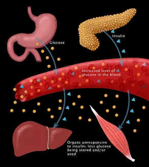 Annotated Prints: Type II diabetes microbiology diagram of insulin