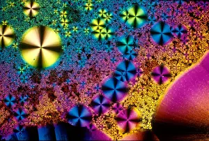 Pathological Prints: Vitamin B1 Crystal