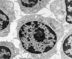 Transmission Prints: White Blood Cells in Leukemia