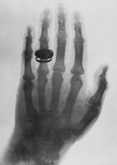 Prints of On January 13, 1896, Röntgen presented his work to Emperor Wilhelm II in Berlin : Wilhelm Roentgen X-ray, First Public Radiograph, 1896