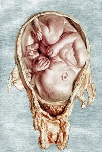 Hunter Prints: William Hunter, Anatomia uteri humani gravidi, 1774