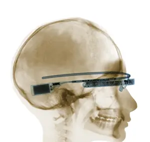 Mixed Science Images Prints: Woman Wearing Google Glass, X-ray