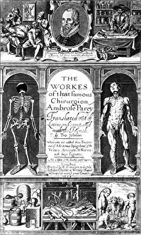 Abnormalities Prints: Workes of That Famous Chirurgion Ambrose Parey