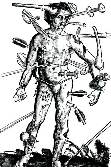 Chart Prints: Wound Man, 'Feldbuch der Wundartzney' 1517