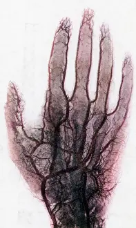 October Prints: X-ray of Blood Vessels