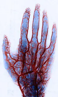 Vein Prints: X-ray of Blood Vessels