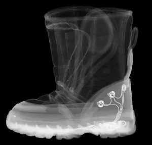 X Rays Prints: X-ray of a Child's Light-Up Boot