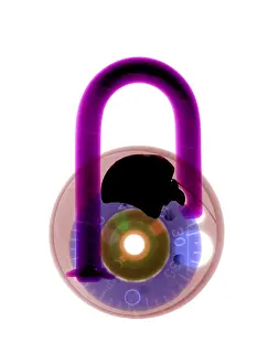 Radiographs Prints: Lock