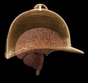 Head Prints: X-ray of Equestrian Helmet