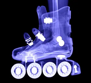 : X-ray of Foot Bones in a Rollerblade Boot