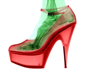 Body Prints: An X-ray of a foot in a High Heel Shoe