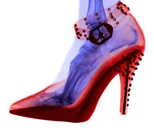 Mixed Science Images Prints: An X-ray of a foot in a High Heel Shoe