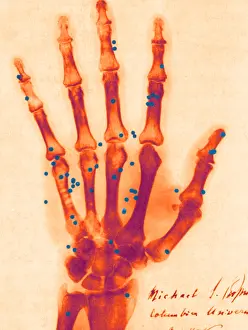 Macabre Prints: X-ray of Gunshot in the Hand, 1896