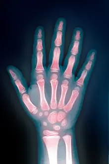 Hand Prints: X-ray of hand