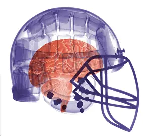 Sport Prints: X-ray of Head in Football Helmet