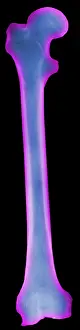 Body Prints: X-ray of Human Femur