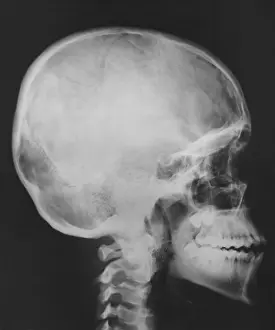 Profile Prints: Skull
