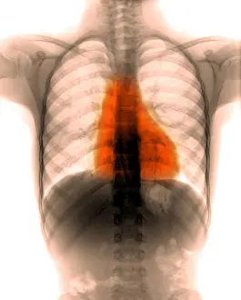 Radiographs Prints: X-ray of thorax and abdomen