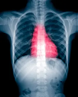 Radiographs Prints: X-ray of thorax and abdomen
